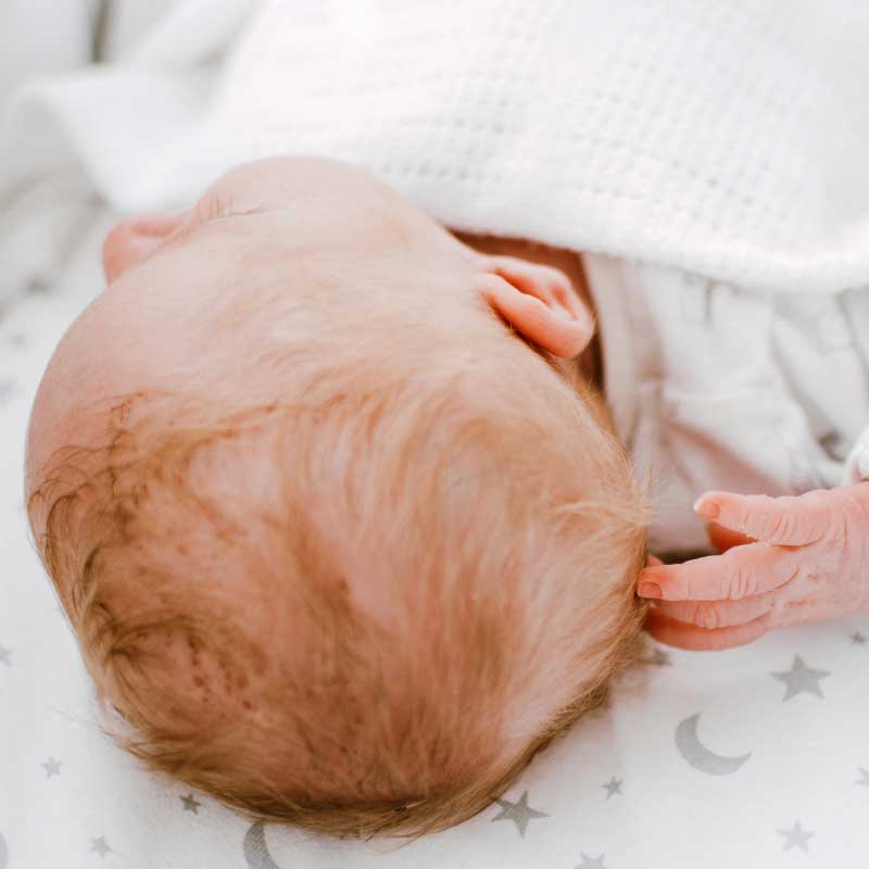 opadanje kose kod beba zbog temenjače