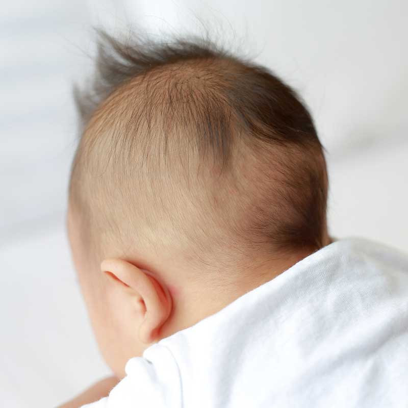 opadanje kose kod beba na potijku
