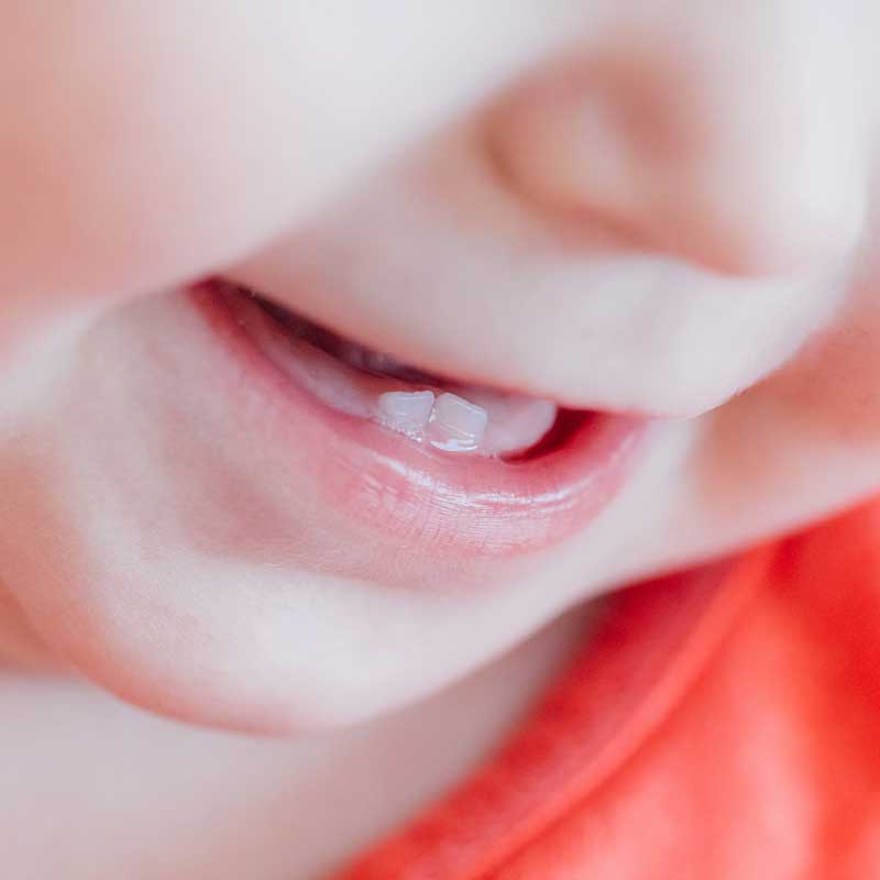 prvi zubi kod beba