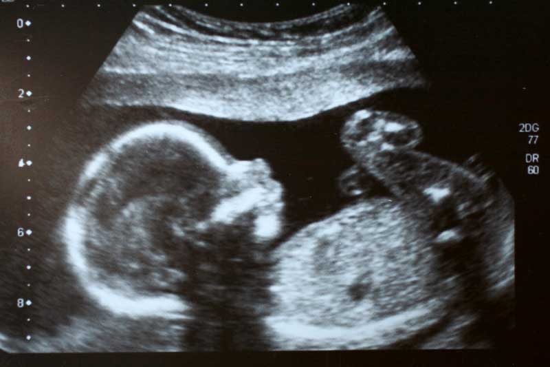 slika bebe na ultrazvuku