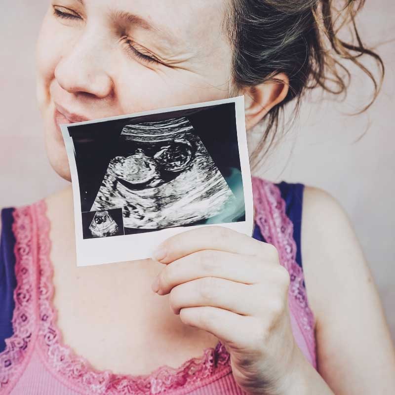 ultrazvuk u 12. nedelji trudnoće