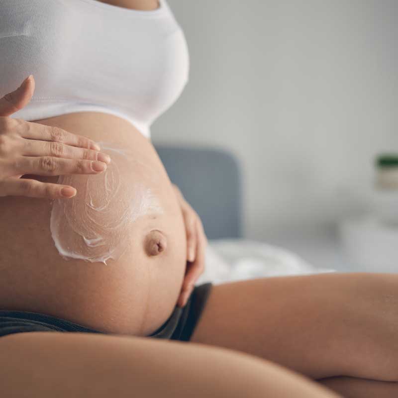 krema za strije u trudnoći